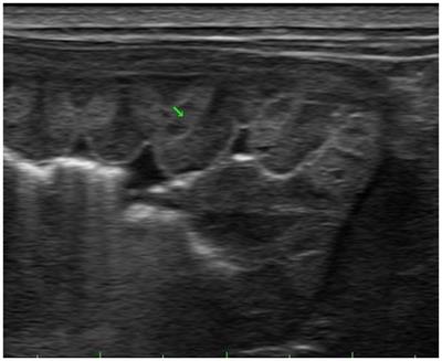 Case report: Fundic gland polyps caused by long-term omeprazole use in a Maltese dog